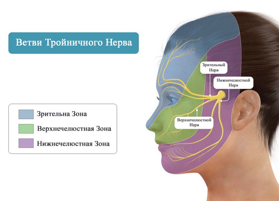 Лицевой нерв справа. Неврология 3 ветви тройничного нерва. Лицевая ветвь тройничного нерва. Невралгия тройничного нерва синдромы. Клинические симптомы невралгии 2 ветви тройничного нерва.